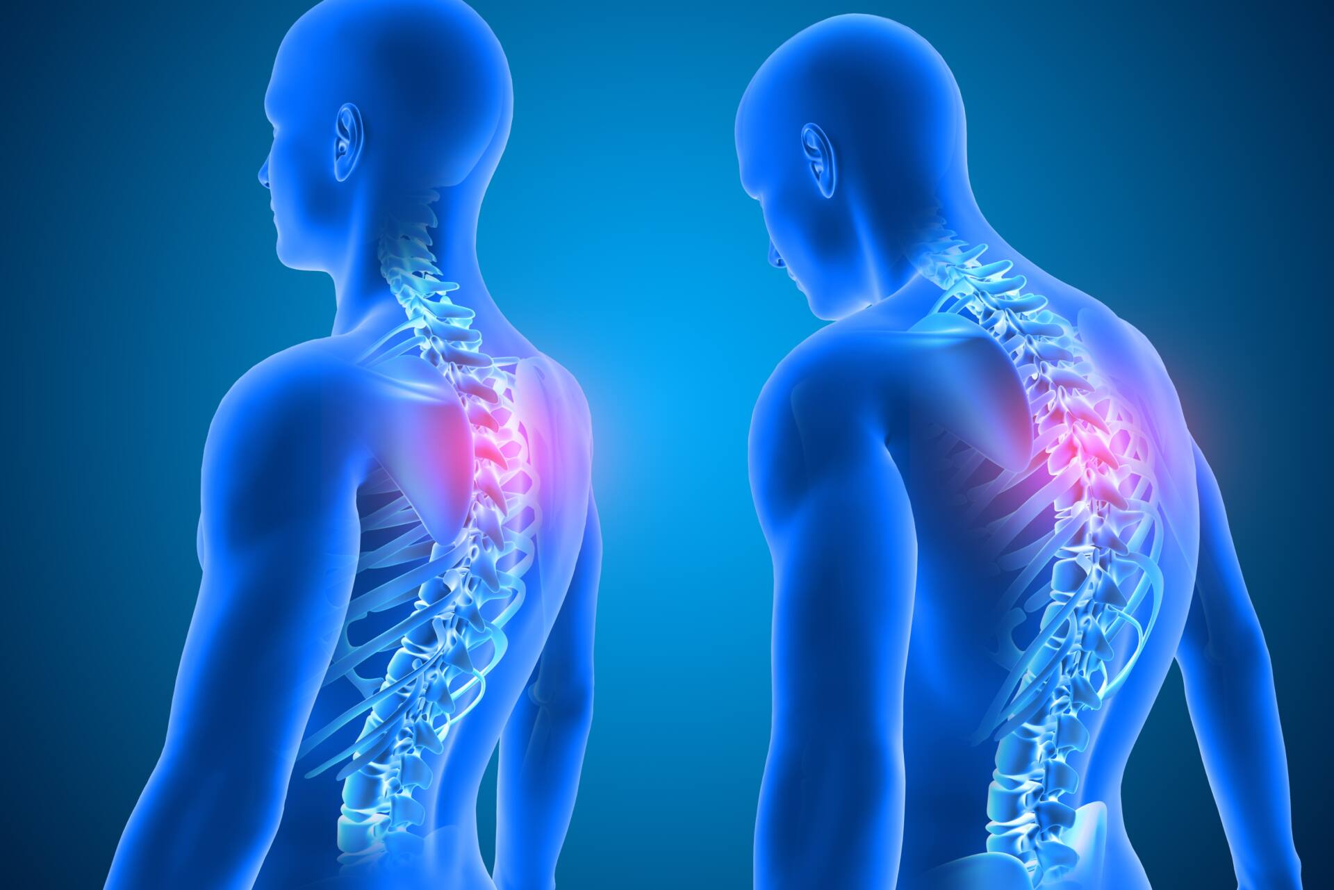 背中の上が痛い