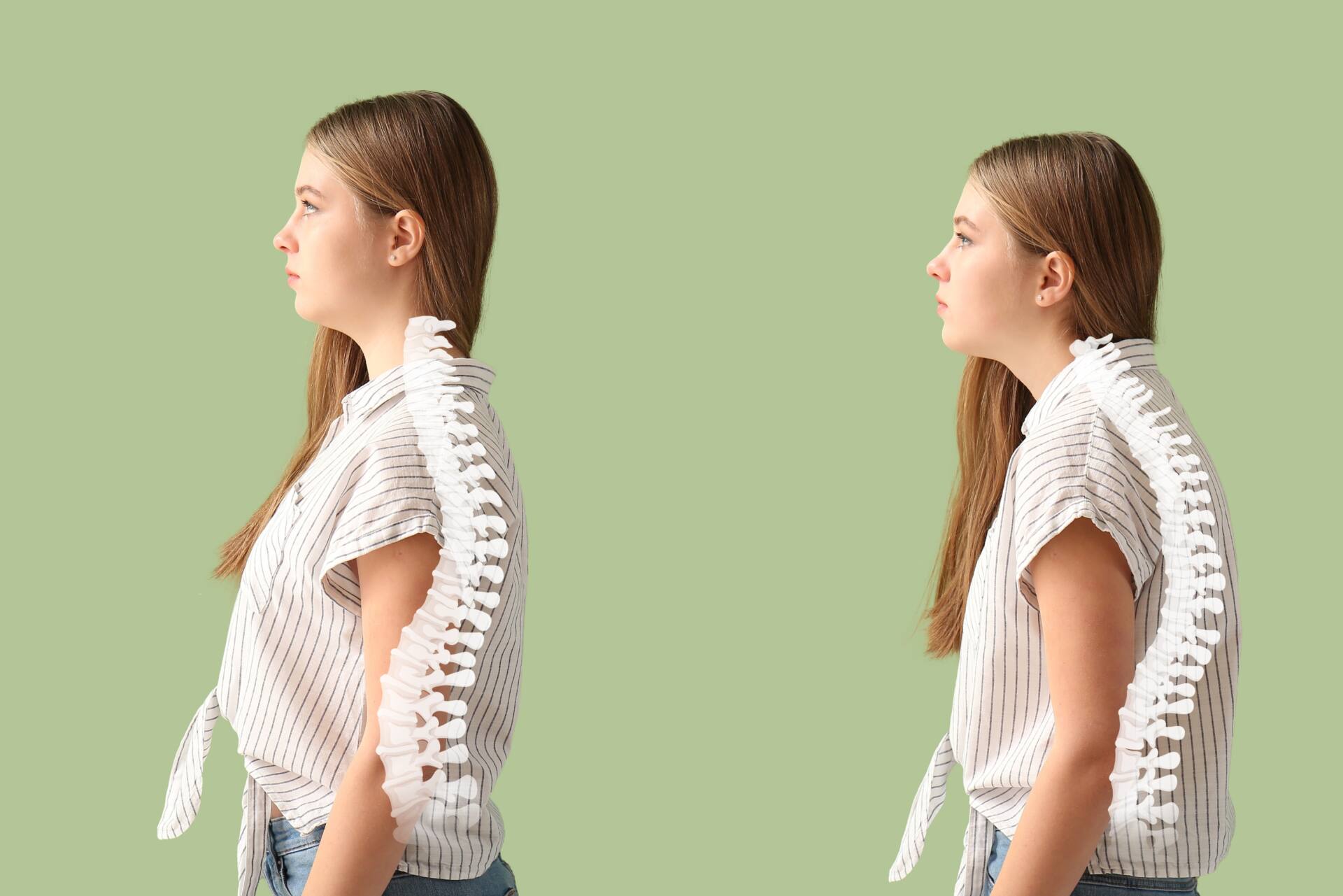 逆流性食道炎、松戸