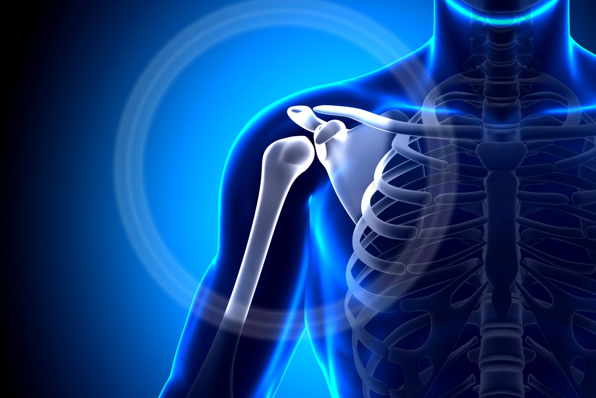 胸郭 出口 症候群 と は