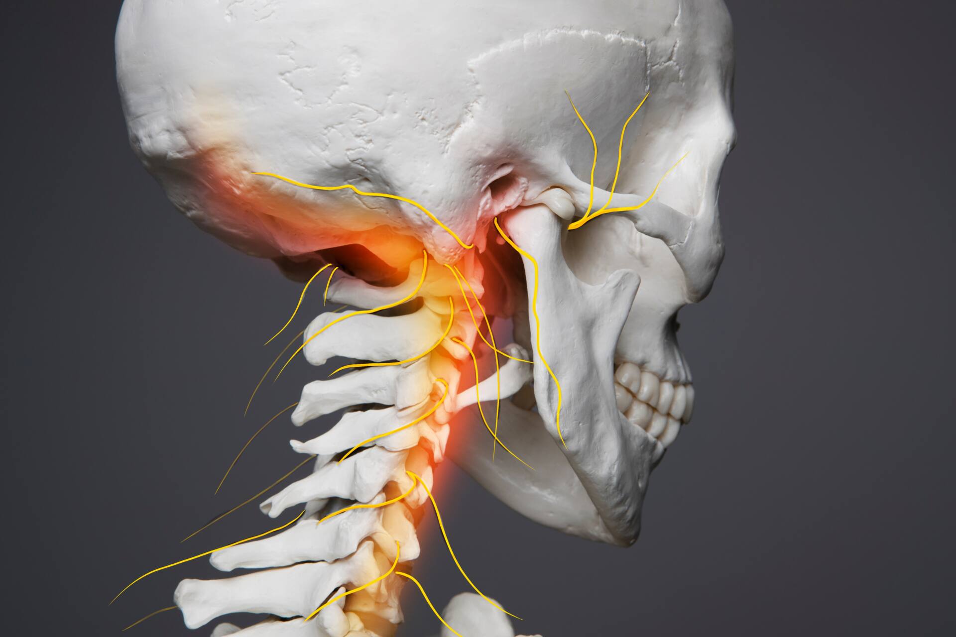 むちうち 後遺症